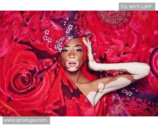 足球明星女友勇敢面对白癜风挑战展现坚强与美丽